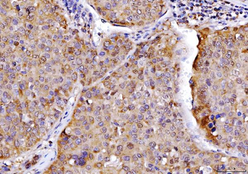 AHA1/AHSA1 Antibody