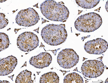 AHA1/AHSA1 Antibody