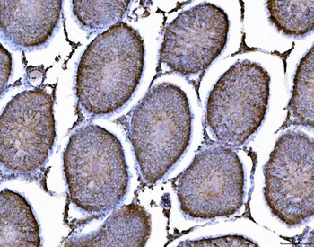 AHA1/AHSA1 Antibody
