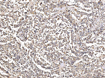 Angiotensinogen/AGT Rabbit Polyclonal Antibody