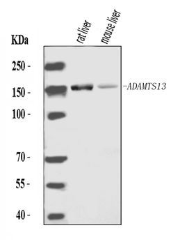 ADAMTS13 Rabbit Polyclonal Antibody