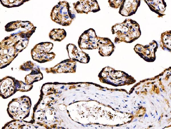 PDIA6 Antibody (monoclonal, 3H5E7)