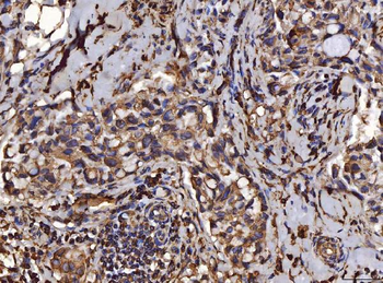 PDIA6 Antibody (monoclonal, 3H5E7)