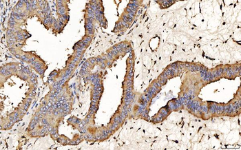 PDIA6 Antibody (monoclonal, 3H5E7)