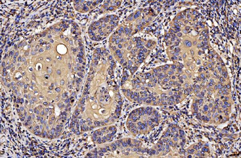 PDIA6 Antibody (monoclonal, 3H5E7)
