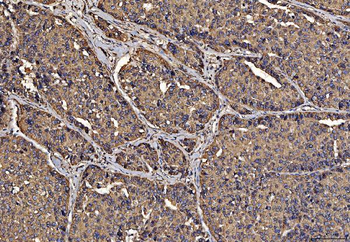 PDIA6 Antibody (monoclonal, 3H5E7)