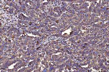 PDIA6 Antibody (monoclonal, 3H5E7)