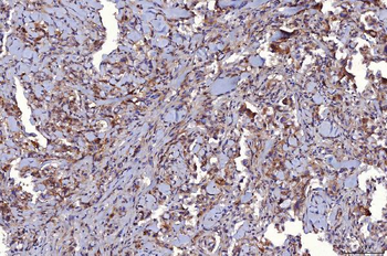 CD147/Emmprin Antibody (monoclonal, 6H2B2)