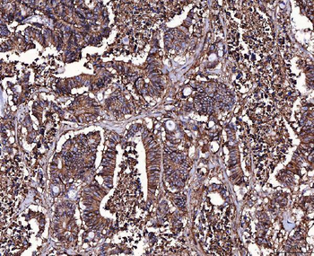 CD147/Emmprin Antibody (monoclonal, 6H2B2)