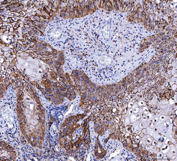 CD147/Emmprin Antibody (monoclonal, 6H2B2)