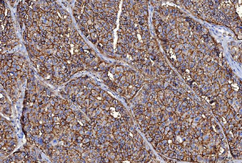 CD147/Emmprin Antibody (monoclonal, 6H2B2)