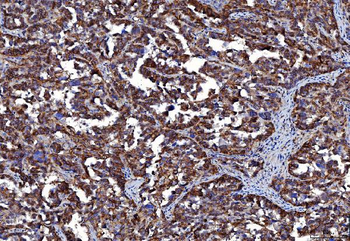 CD147/Emmprin Antibody (monoclonal, 6H2B2)
