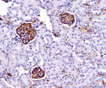 CD147/Emmprin Antibody (monoclonal, 6H2B2)