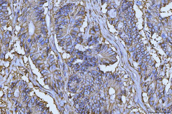 CD147/Emmprin Antibody (monoclonal, 7H5E7)