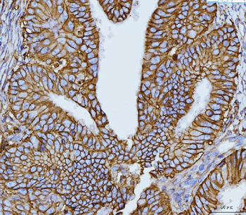 CD147/Emmprin Antibody (monoclonal, 7H5E7)