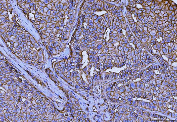 CD147/Emmprin Antibody (monoclonal, 7H5E7)
