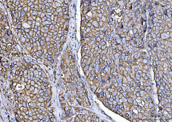 CD147/Emmprin Antibody (monoclonal, 3B13G7)