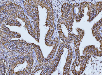 CD147/Emmprin Antibody (monoclonal, 3B13G7)