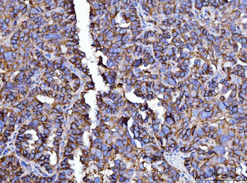 CD147/Emmprin Antibody (monoclonal, 3B13G7)