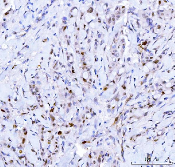 Cdk2 Mouse Monoclonal Antibody
