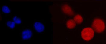 PCBP2/hnRNP E2 Mouse Monoclonal Antibody
