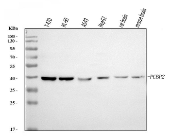 PCBP2/hnRNP E2 Mouse Monoclonal Antibody