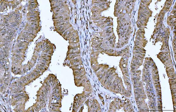 YWHAE Antibody (monoclonal, 3G11G2)
