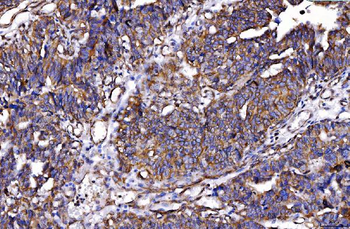 HGS Antibody (monoclonal, 4B7E2)