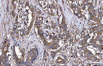 HGS Antibody (monoclonal, 4B7E2)