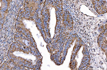 HGS Antibody (monoclonal, 4B7E2)