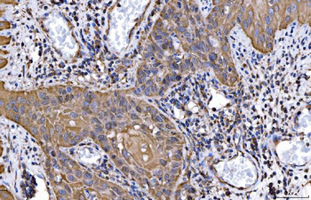 HGS Antibody (monoclonal, 4B7E2)