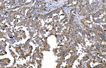 HGS Antibody (monoclonal, 4B7E2)