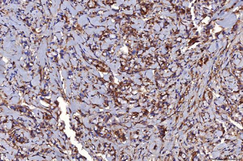 HGS Antibody (monoclonal, 6C2E1)