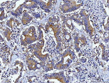 HGS Antibody (monoclonal, 6C2E1)
