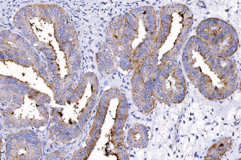 HGS Antibody (monoclonal, 6C2E1)