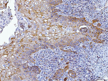 HGS Antibody (monoclonal, 6C2E1)