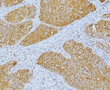 YY1 Antibody (monoclonal, 3F3E7)
