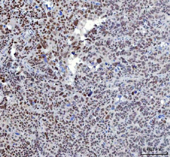 YY1 Antibody (monoclonal, 3F3E7)