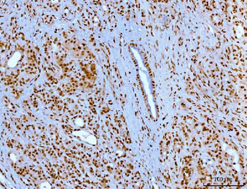 YY1 Antibody (monoclonal, 3F3E7)