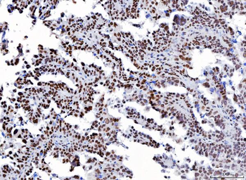 YY1 Antibody (monoclonal, 3F3E7)
