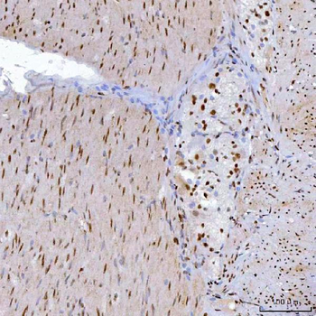 YY1 Antibody (monoclonal, 3F3E7)