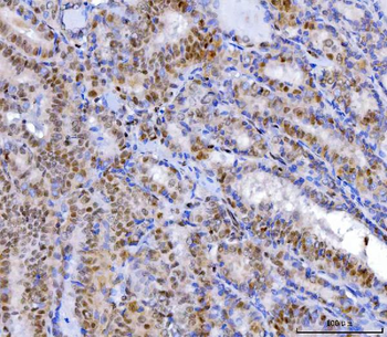 YY1 Mouse Monoclonal Antibody