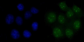 FEN1 Antibody (monoclonal, 7D11D7)