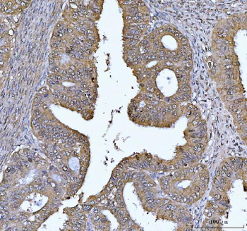 FEN1 Antibody (monoclonal, 7D11D7)