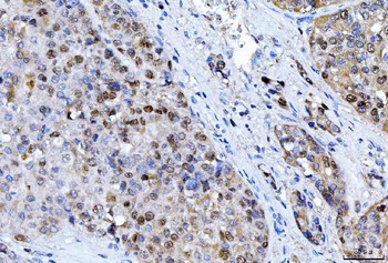 FEN1 Antibody (monoclonal, 7D11D7)