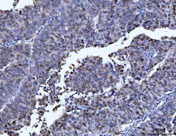 FEN1 Antibody (monoclonal, 7D11D7)