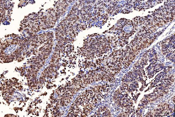 FEN1 Antibody (monoclonal, 6F3F2)