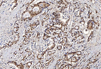 FEN1 Antibody (monoclonal, 6F3F2)