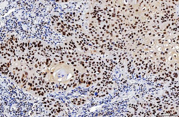 FEN1 Antibody (monoclonal, 6F3F2)