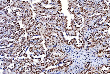 FEN1 Antibody (monoclonal, 6F3F2)
